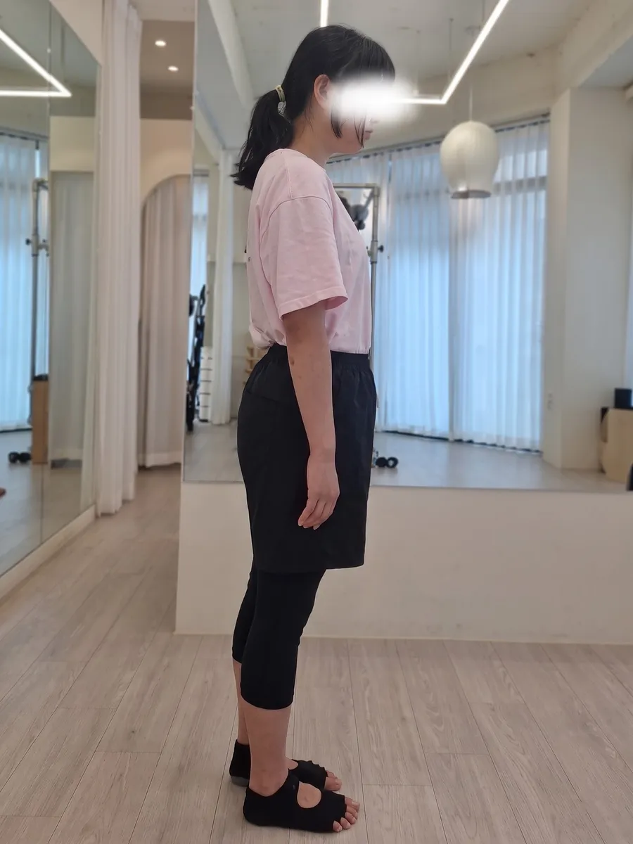 소뇌 손상 회원 · 5개월 40회 1회차 옆모습 1 자세 비교 사진