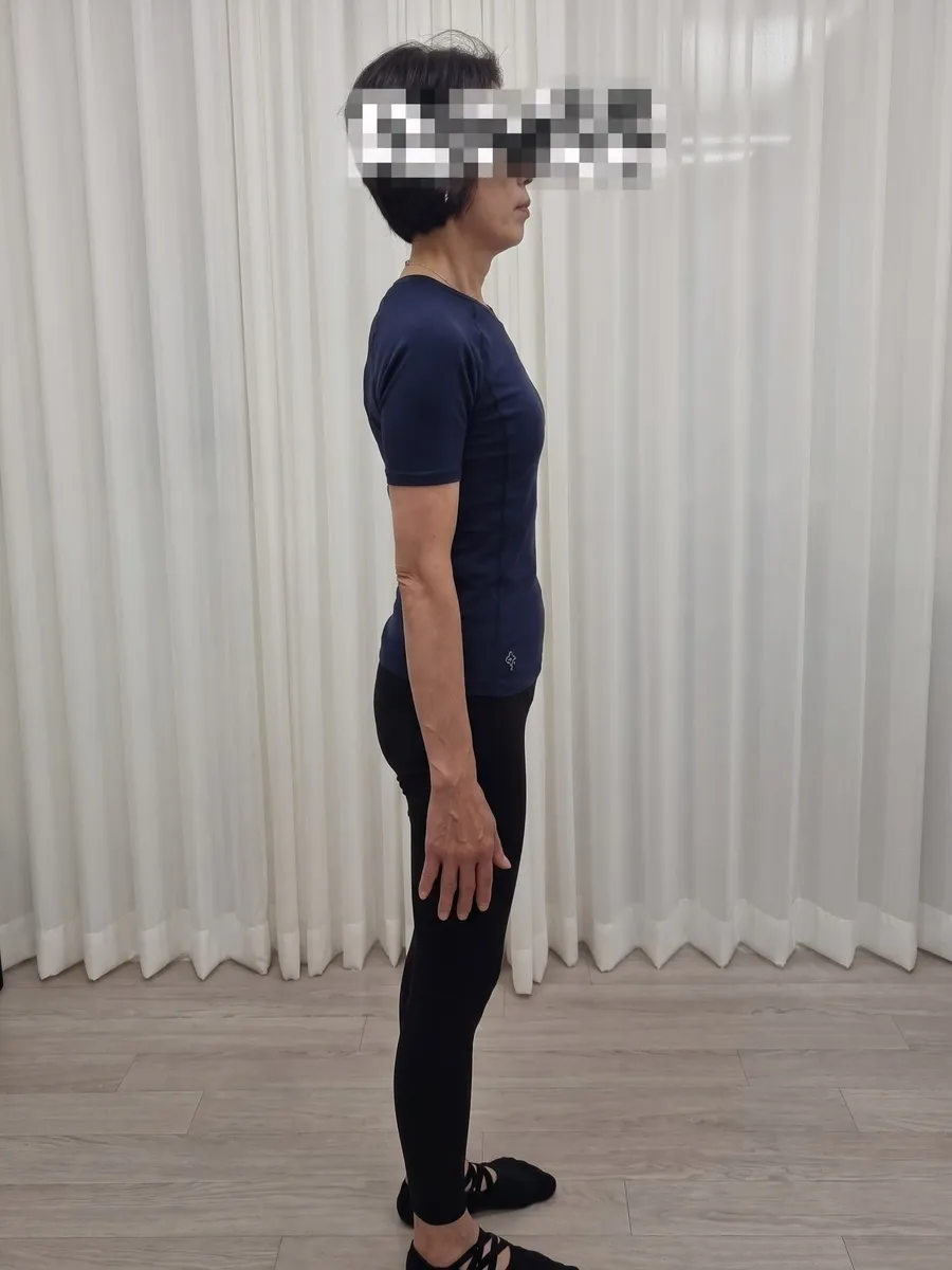60대 회원 · 3년 · 주 1회 3년 후 옆모습 1 자세 비교 사진
